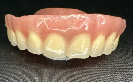 removable denture